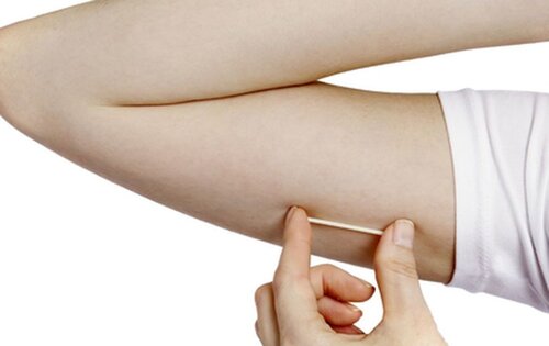 implante-contraceptivo